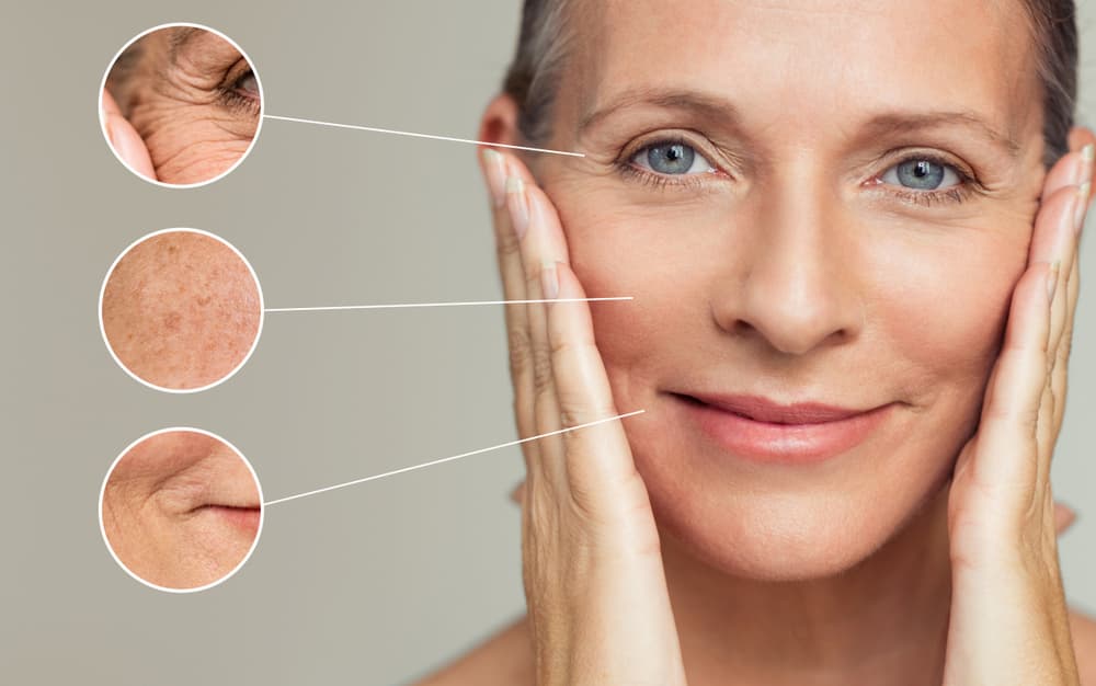 causes of wrinkles