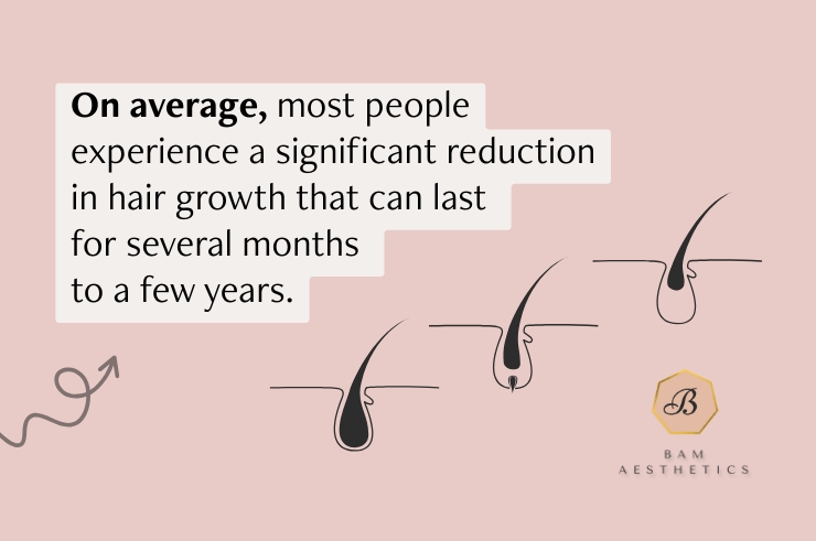 How Long Does Laser Hair Removal Last?